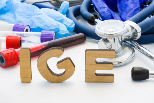 What is an IgE test?