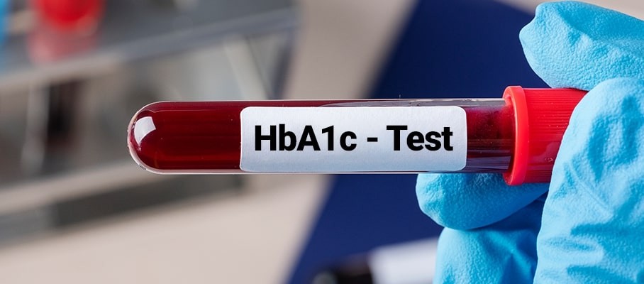 What kinds of POCT HbA1c devices have been available in the market?