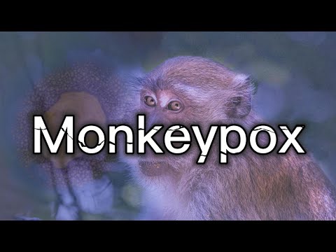 Understanding Monkeypox: History, Symptoms and Awareness
